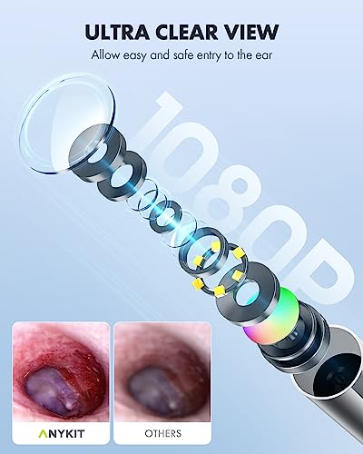 Digital Otoscope with Ear Wax Removal Tools D263947