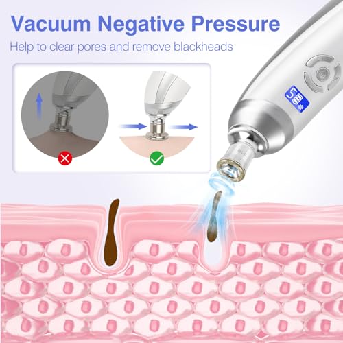 Diamond Micro-dermabrasion Machine O82706